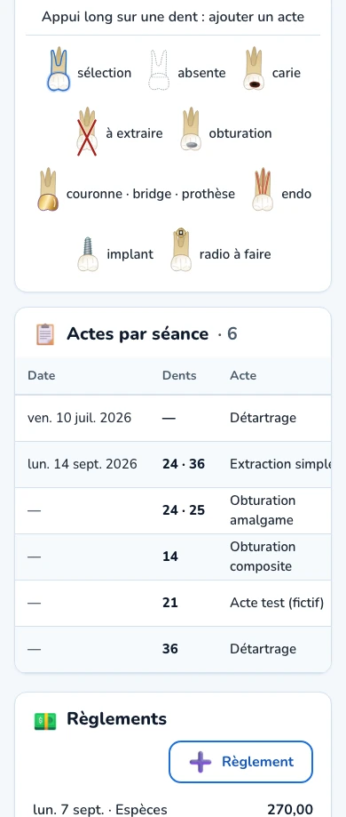 La fiche de traitement de Dental OS sur un téléphone : légende du schéma dentaire, actes par séance et règlements