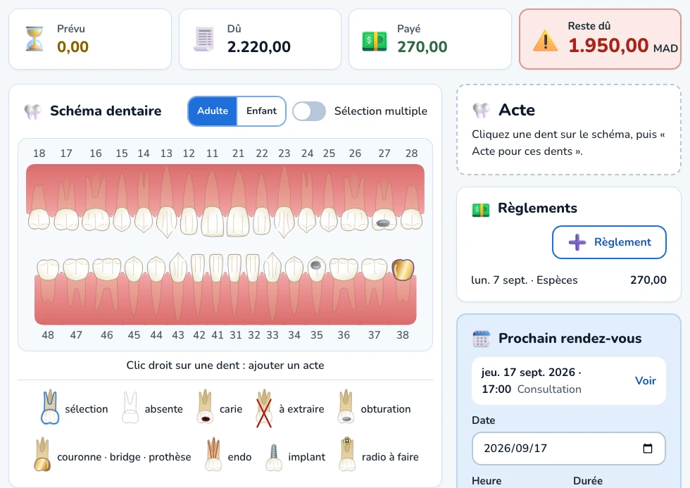 Fiche de traitement de Dental OS : montants prévu, dû, payé et reste dû, schéma dentaire avec sa légende, règlements et prochain rendez-vous